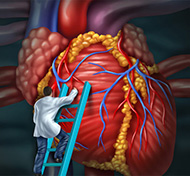 Heart Attack 101: What men and women should know : http://health.sunnybrook.ca/heart/heart-attack-faq/