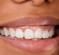 teeth http://health.sunnybrook.ca/wellness/dentist-more-than-teeth/