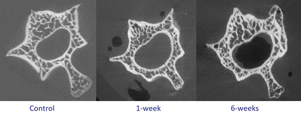 Structural augmentation in the vertebrae, with increased bone deposition seen at 1 and 6 weeks post treatment  