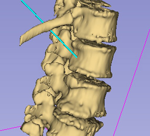 Image of a spine.