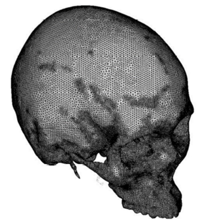 Computed tomography (CT) 3D geometrical reconstruction of the skull.