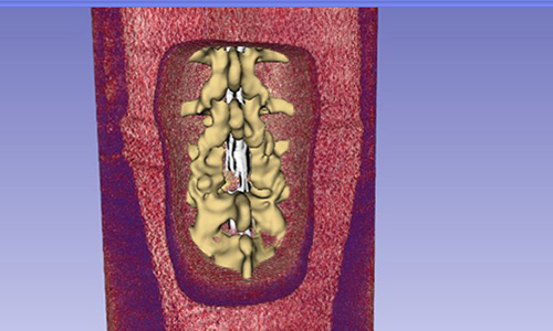 A 3D simulation of a spine, through flesh.