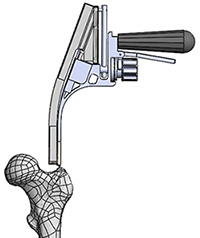 The Femoral Antegrade Starting Tool.