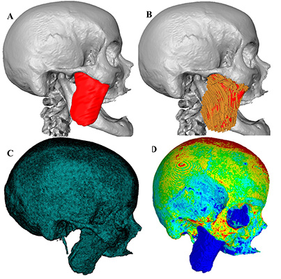 A) Masseter and skull volumes obtained from MRI and CT, B) Masseter fiber architecture obtained from DTI within the masseter volume, C) Mesh generation of the skull and masseter, D) Heterogeneous distribution of bone elastic modulus obtained using CT-based bone densities.