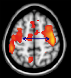 Brain image