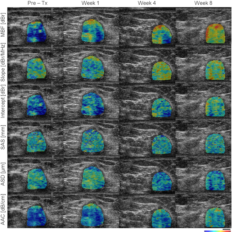 Ultrasound-based imaging technique