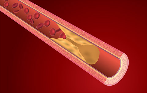 Illustration of artery