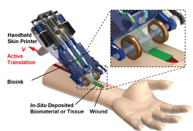 A rendering of the skin printer
