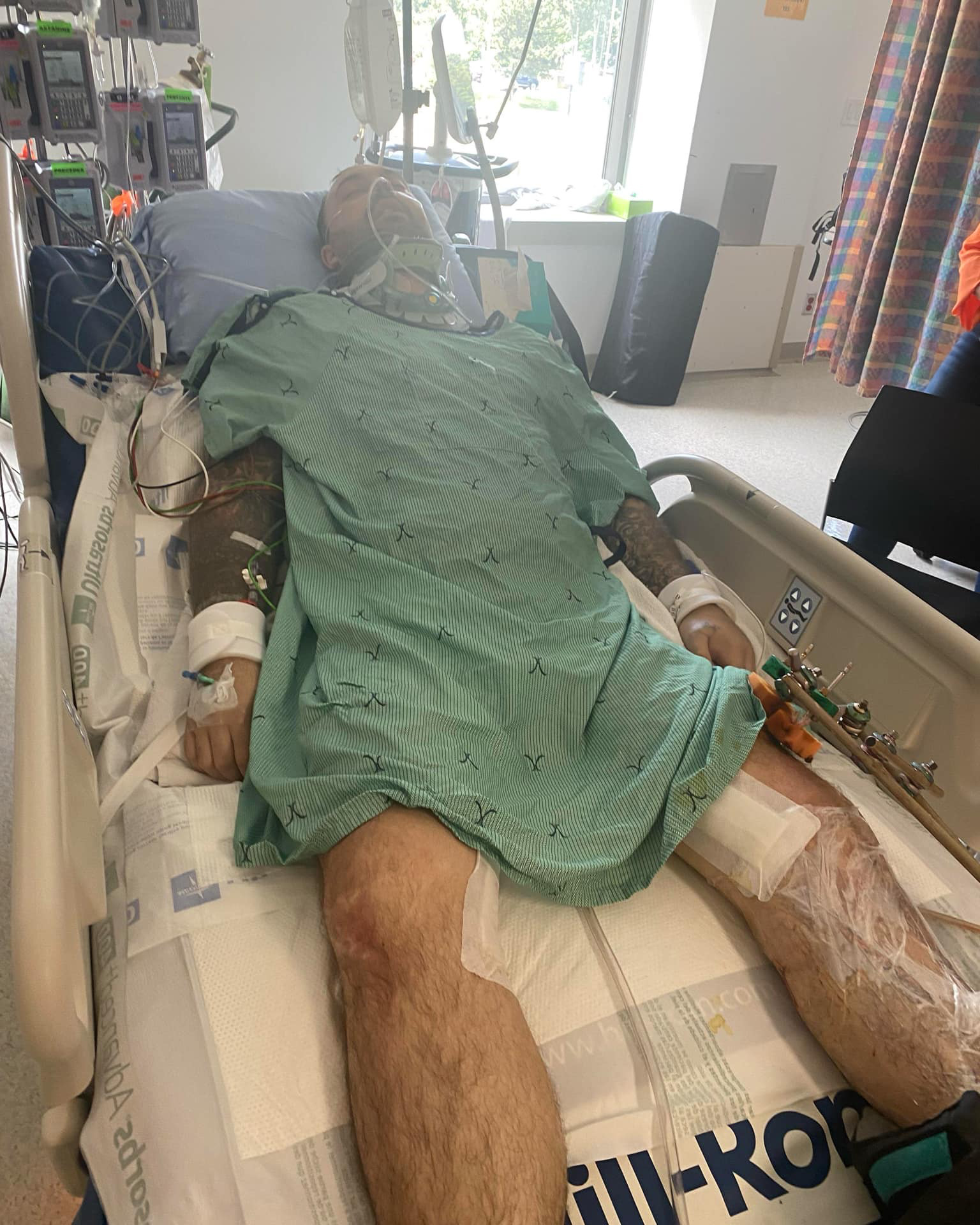 Johnathan Laporte in a coma