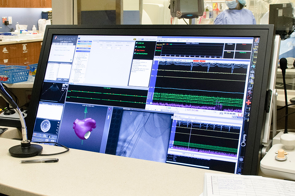 Heart monitoring software
