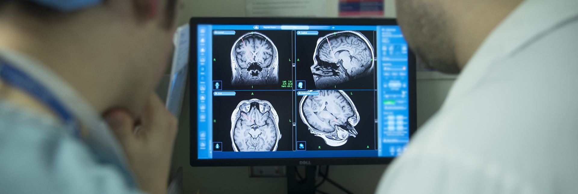 Clinicians view a monitor with a brain scan