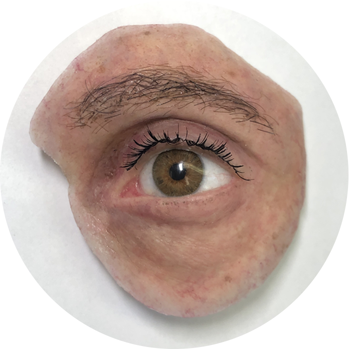 Ocular / Orbital