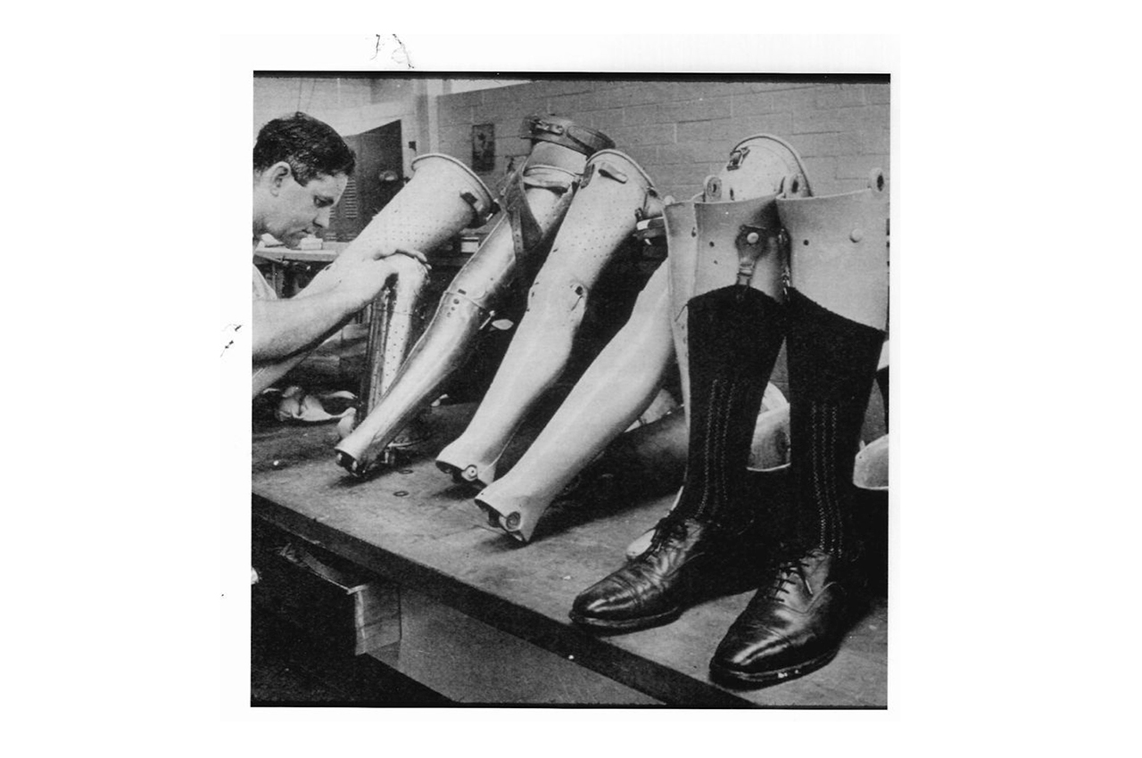 Prosthetics at Sunnybrook. 1949