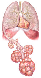 Respirology - Sunnybrook Hospital