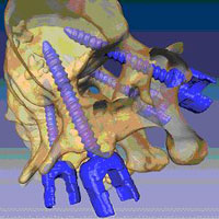 Orthopaedic Biomechanics Laboratory - Projects - Computer-Assisted ...